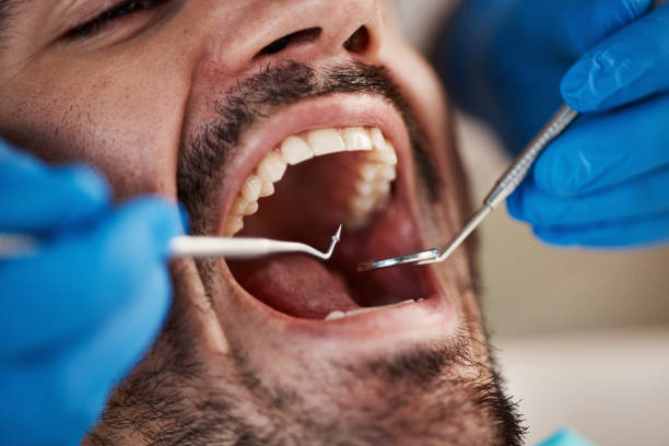 Best Orthodontic Emergency Dentist in Vaughn, WA