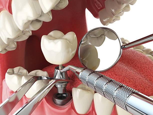 Best Pediatric Emergency Dentist in Vaughn, WA